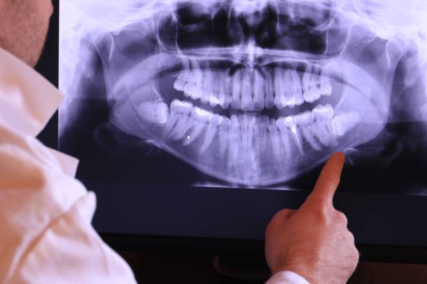 Best Dental Abscess Treatment in Wayne, WV