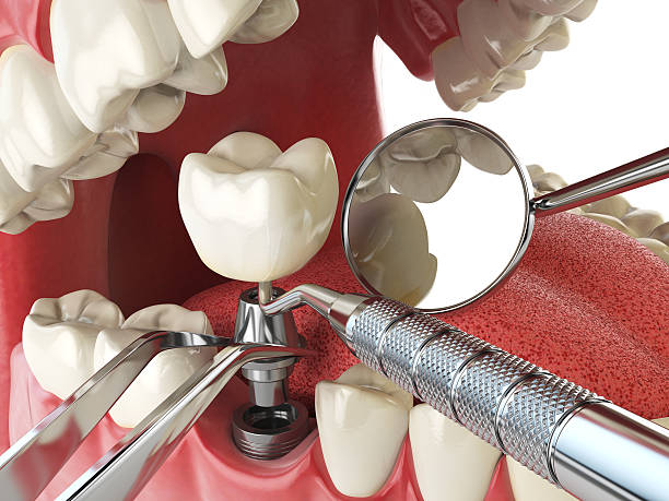 Best Emergency Root Canal Therapy in Wayne, WV